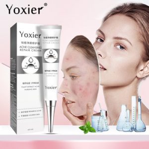 Yoxier Acne Treatment Blackhead Remova Anti Acne Cream Whitening Shrink Pores Face Care  Acne Scar Remove Oil Control Skin Care