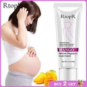 Mango Remove Pregnancy Scars Acne Cream Stretch Marks Treatment Maternity Repair Anti-Aging Anti-Winkles Firming Body Creams