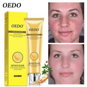 Plant Extraction Repair Acne Cream Ginseng Scutellariae Extract Face Care Acne Treatment Skin Care Facial Cream Whitening 20g