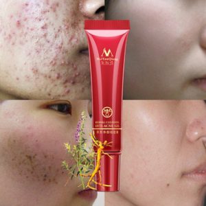 Herbal Anti-acne Repair Face Cream Remove Acne Moisturizing Nourishing Facial Gel Acne Marks Lighten Tone Whitening Skin Care