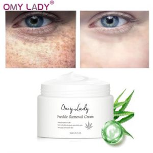 OMY LADY Freckle Removal Cream Remove Freckle Pregnant Spots Melanin Dark Spots Anti Aging Whitening Facial Cream Brightening